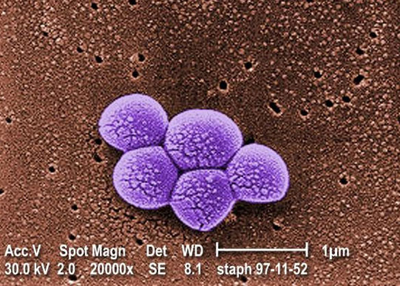 MRSA Bacteria